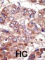 FACL6 Antibody (Center)